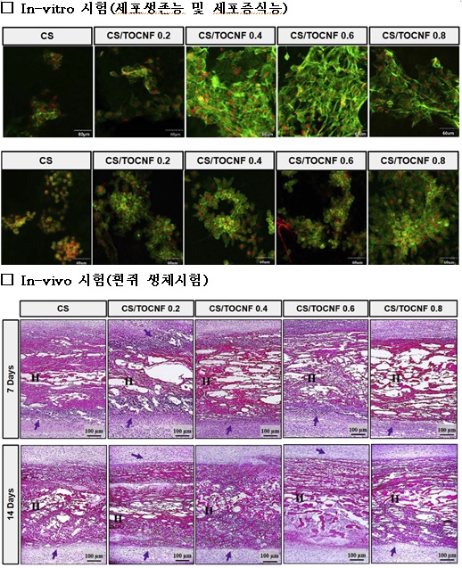 수술용 유착 방지제도 나무로 만든다 수술용 유착 방지제도 나무로 만든다